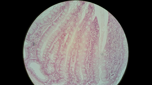 Colon Slides - Colon 001 400X